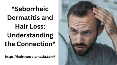 Seborrheic Dermatitis And Hair Loss Understanding The Connection