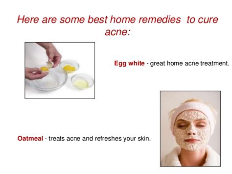 Home Treatment For Acne Dorothee Padraig South West Skin Health Care