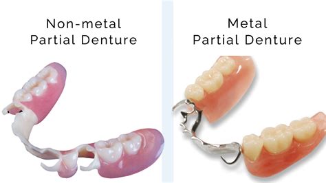 What Are Dentures And How Do They Work Revitalise Dental Centre A Pair Of Upper And Lower