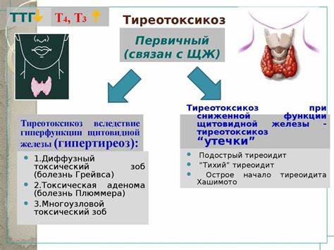 Диета при воспалении щитовидной железы Диета При Тиреотоксикозе Щитовидной Железы У Женщин — Похудение Диета Диета При Тиреотоксикозе Щитовидной Железы У Женщин — Похудение Диета Диета при воспалении щитовидной железы