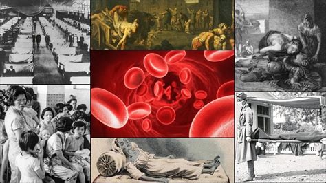 Coronavirus ¿cuáles Fueron Las 10 Epidemias Más Letales De La Historia
