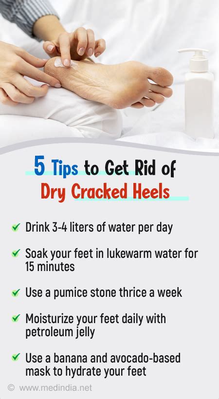 Easy Home Remedies For Dry Cracked Heels Atelier Yuwaciaojp
