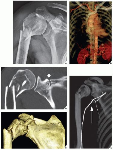 Imaging Techniques In Orthopaedics Radiology Key