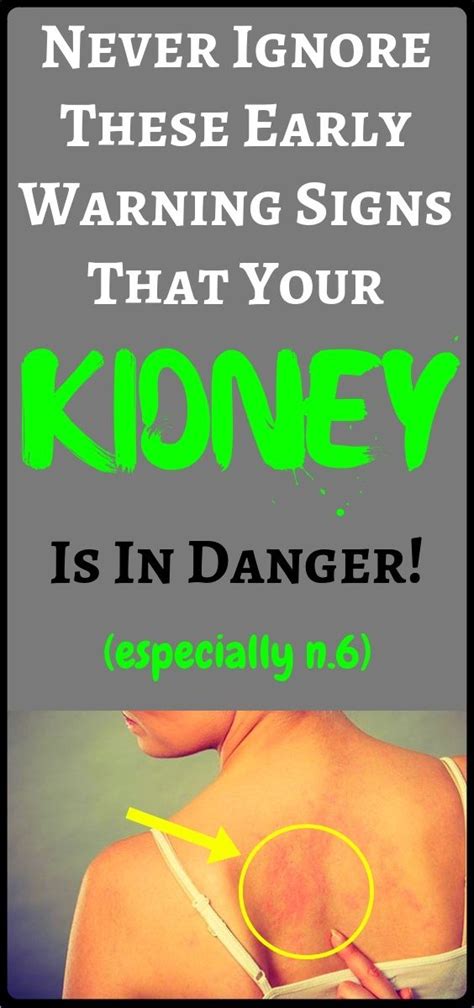 Early Warning Signs Of Kidney Disease Kidney Anatomy Medical Anatomy