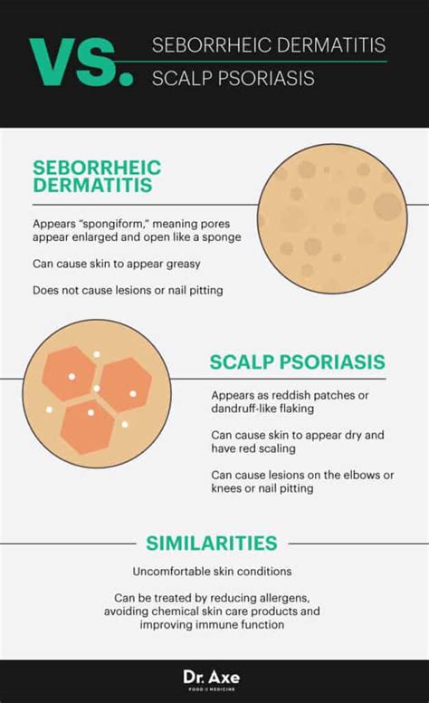 Seborrheic Dermatitis Causes 7 Natural Treatments Dr Axe