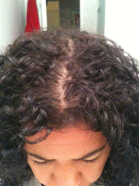 So you've got hair dye on your skin. Pin on Natural Beauty