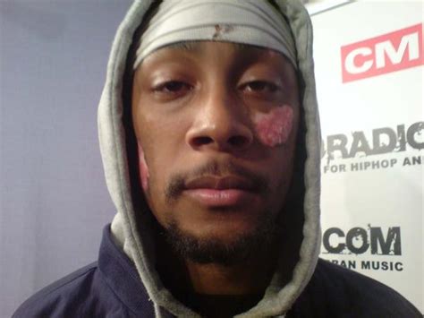 London Grime Pioneer Stormin Dies From Skin Cancer At 24 The Source
