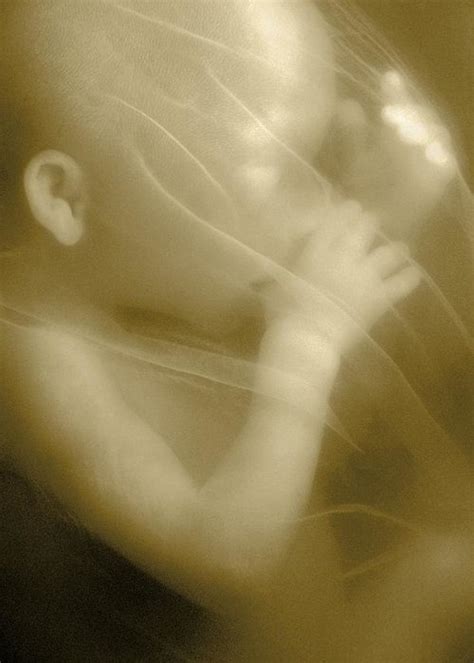 Human Foetus In The Womb Photograph By Science Photo Library
