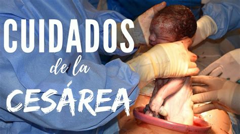🤷🏽‍♀️🤷🏻‍♂️cómo Cuidar La CesÁrea Baby Suite By Pau Youtube