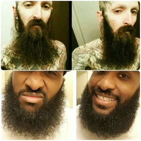 Before And After An Application Of Beats Beard Natural Beard Oil