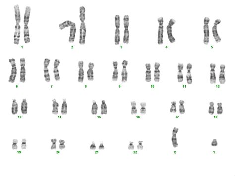 2autosomes And Sex Chromosomes Ga Mfon