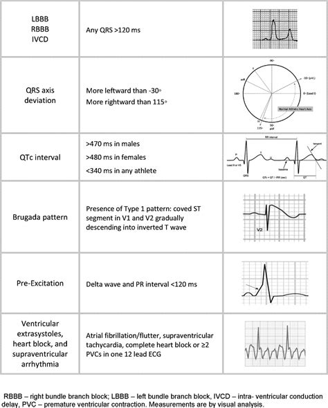 Interpretation Of The Electrocardiogram Of Young Athletes Circulation