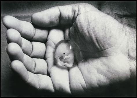 8 Week Human Foetus In Palm Of Hand Photograph By Dr Ma Ansary
