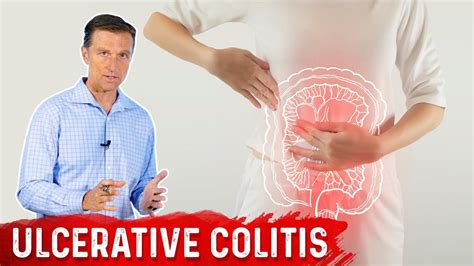 What Is Ulcerative Colitis Causes Symptoms And Treatment By Dr Berg Youtube