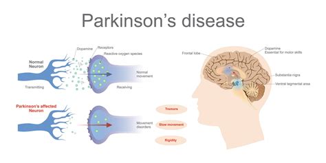 This area is responsible for the production of dopamine. What Are The Best Essential Oils And Recipes To Manage ...