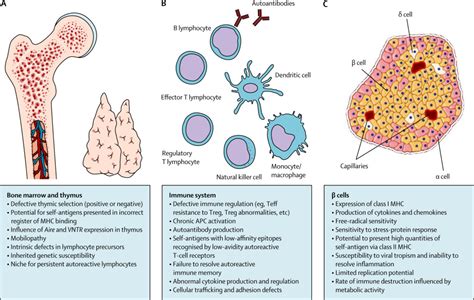 Type 1 Diabetes The Lancet