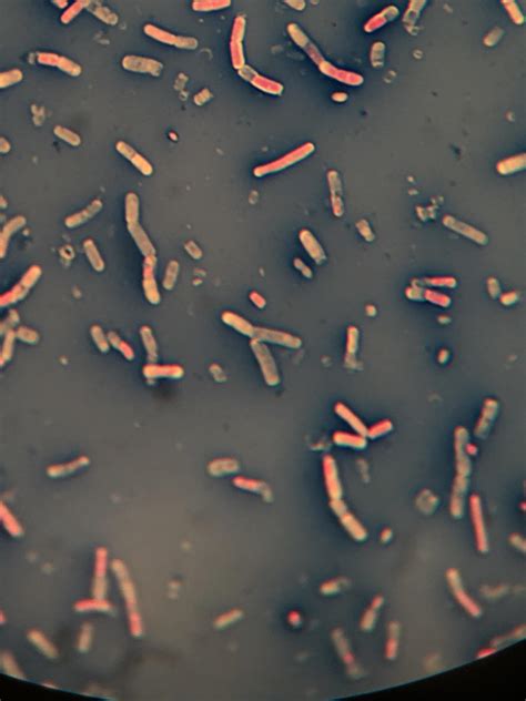 Photo Of Bacillus Megaterium I Took Last Week Capsule Stain R