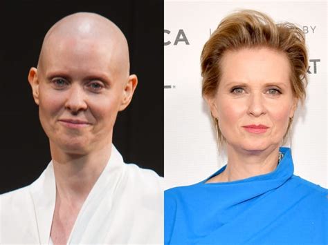 Celebrities Who Have Shaved Their Heads For Roles