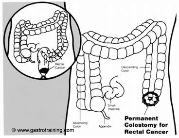 gastroenterology education  cpd  trainees