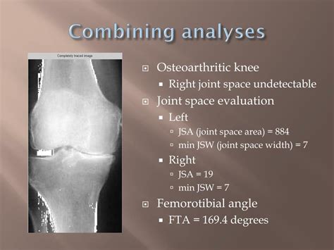 Ppt Quantifying Knee Osteoarthritis Powerpoint Presentation Free