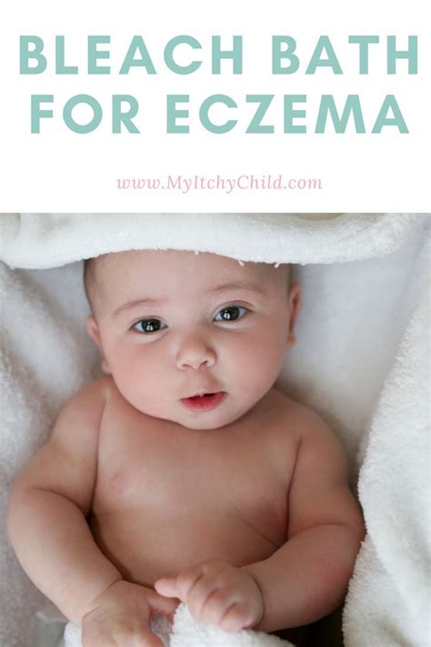 Bleach Baths For Eczema In Babies My Itchy Child Baby Eczema