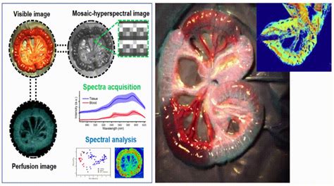 Multimodal Imaging Of Laser Speckle Contrast Imaging Combined With