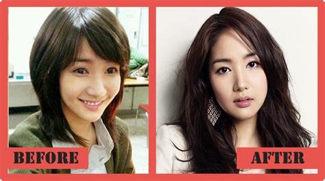 Park Min Young Plastic Surgery With Before And After Photos