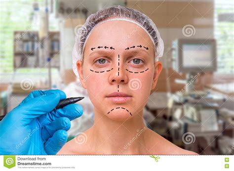Plastic Surgery Doctor Draw Lines With Marker On Patient Face Stock