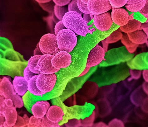 Oral Streptococcus Bacteria Photograph By Science Photo Library