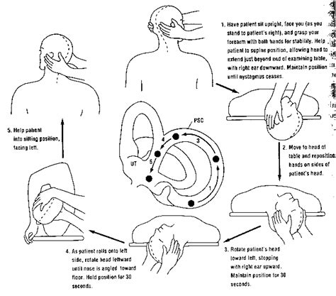 These movements bring the crystals back to the utricle, where they belong. Medical Health Treatment and Therapy : Medical Treatment ...