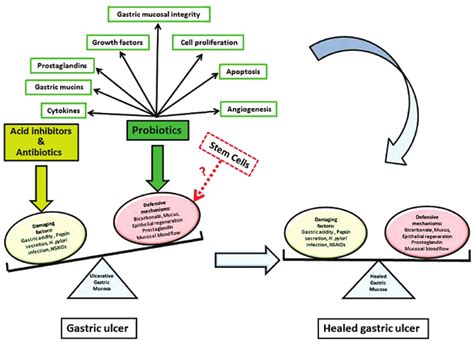 Summary Of Gastric Ulcer Etiology And Different Treatment Options Download Scientific Diagram