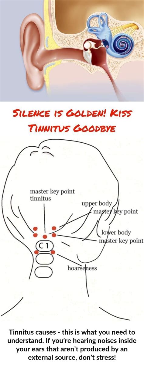 Tinnitus Is Most Notieceable When You Find Yourself On Your Own In What