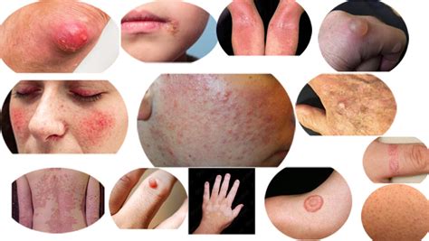 Learn About Common Skin Disorders Health Beauty Tips