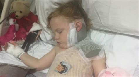 Four Year Old Girl Badly Burnt After Firework Explodes In Her Scarf
