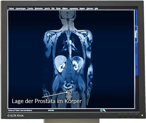 Funktion und anatomie der prostata. Prostata - Informationen zur Vorsorge und zur Diagnose