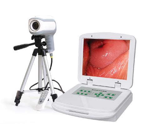 Portable Vagina Camera Colposcope Automatic Optical Inspection System