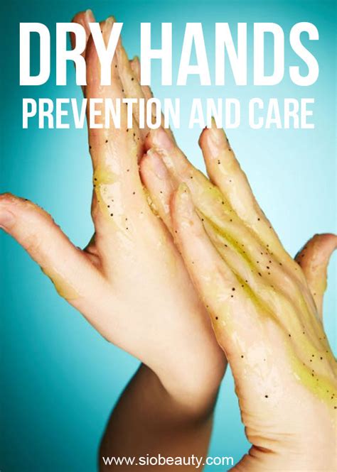 Dry Hands Causes Symptoms Prevention And Care