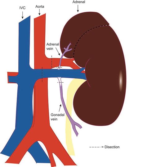 Browse our kidney diagram labeled images, graphics, and designs from +79.322 free vectors graphics. Kidney diagram with labels | Flickr - Photo Sharing!