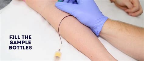Venepuncture Osce How To Take Blood Venipuncture