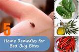 Photos of Home Remedies For Pimples And Their Marks