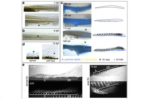 Development Of The Anal And Dorsal Fins Of A Burtoni A