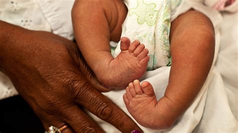 What Is Clubfoot Cure