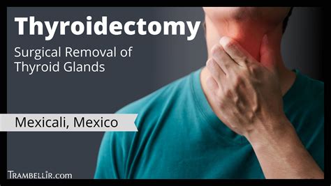 Thyroidectomy Surgical Removal Of Thyroid Glands Trambellir