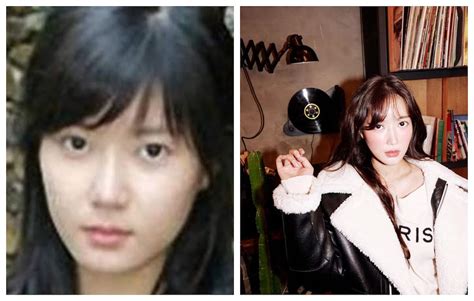 Im Soo Hyang Plastic Surgery Details Before And After Looks Ke