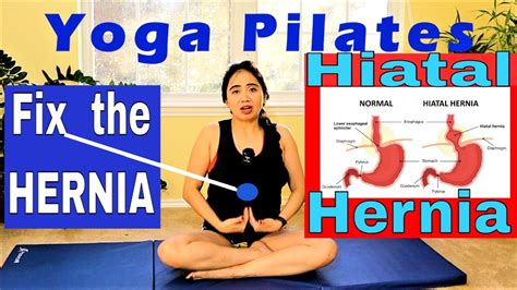 discover 149 yoga poses for hiatal hernia best vn