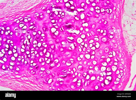 Hyaline Cartilage From Trachea Showing Chondrocytes Collagen Fibers