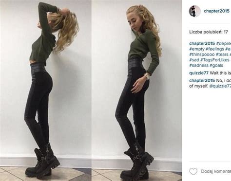 Anorektyczki z Instagrama Szukają akceptacji czy pomocy Papilot