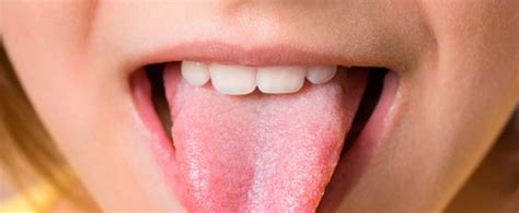 Glossitis Entzündung Der Zunge Ursachen And Behandlung