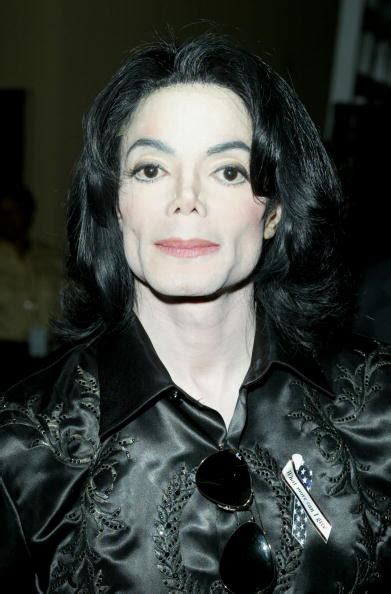 Michael Jacksons Skin Disorder Now Becoming Fashionable Science Times