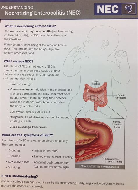 Understanding Necrotizing Entercolitis Nec Nec Neonatal Nurse